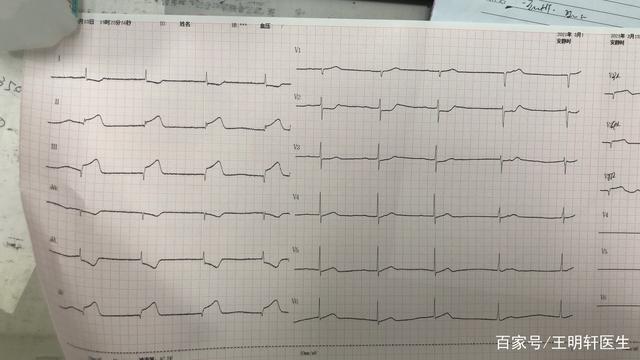 急性心肌梗死也是可以预防的