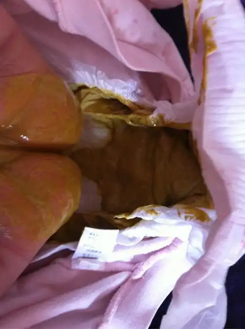 拉稀屎的图片搞笑