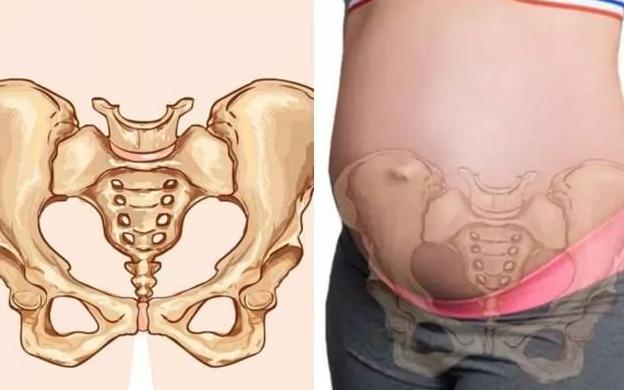 孕晚期常见的这种痛,折磨孕妈痛苦不堪,了解清楚再做预防更重要_耻骨