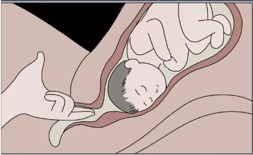 顺产"开十指"是怎么开的?一组过程图让你明白:什么叫为母则刚