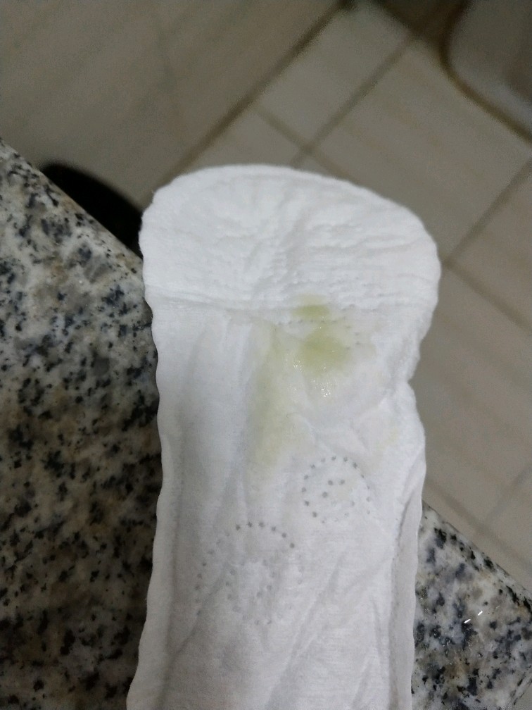 从今早开始流黄色的白带,腰有点酸