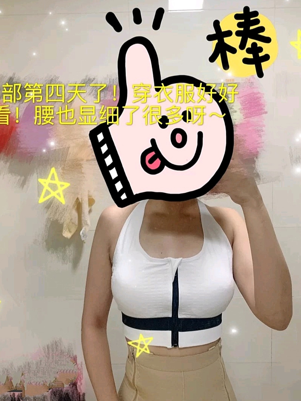 哈喽,今天是我做自体脂肪丰胸的第二个月了,终于感受到c罩杯的欢乐了.