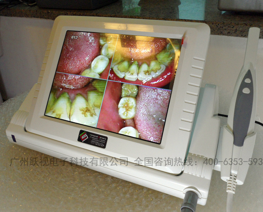 8寸液晶口腔内窥镜一体机 口腔检测仪 口腔放大镜