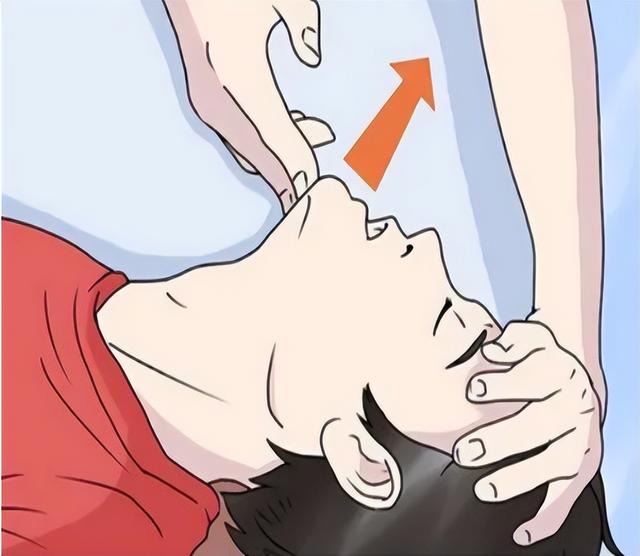 口对口人工呼吸该如何做?医生讲解