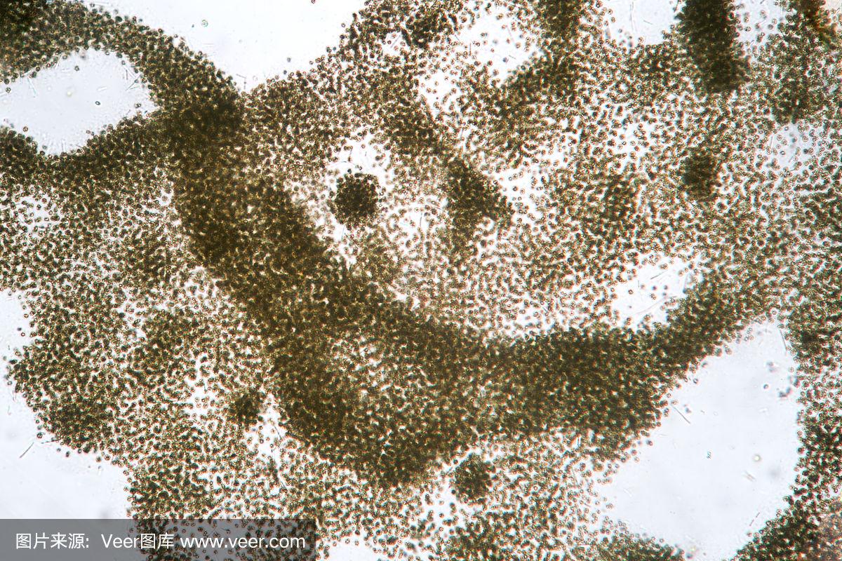 超宏观显微镜.水开花污染的生态问题