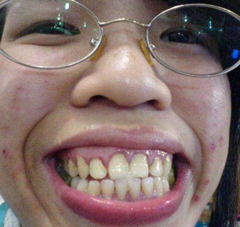 世界最丑的女人