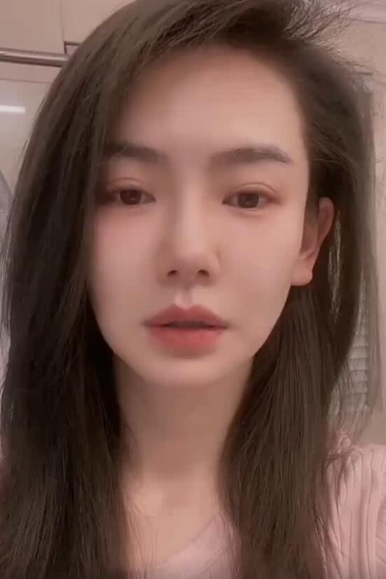 原创戚薇大方承认割了双眼皮看到她闭眼后的样子比天生的还自然