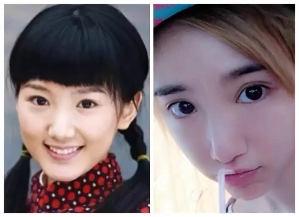 经历了男友劈腿,亲爹讹钱之后,毛晓彤的脸也整的认不出了?