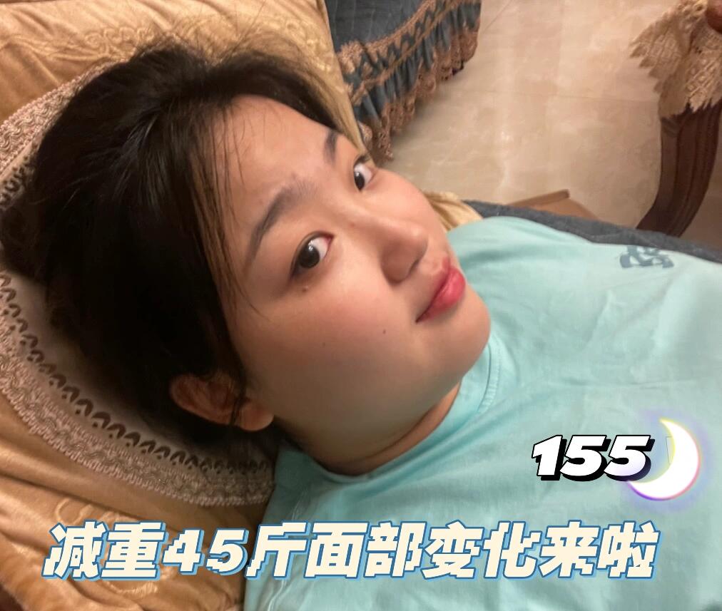 减肥45斤,面部对比图来啦,瘦了真的会变漂亮