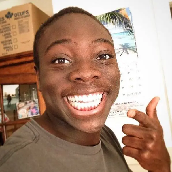 黑人牙齿为什么辣么白