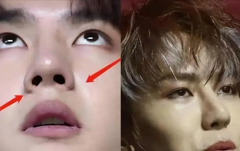 原创王一博新剧状态堪忧整容后遗症明显年代戏镜头里全暴露