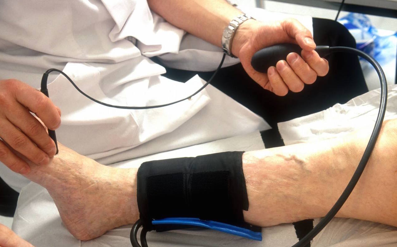 正常人下肢血压略高,是上肢的血压1.1倍左右.