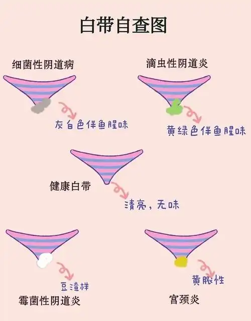 白带发黄是怎么回事 女性分泌物发黄是什么原因