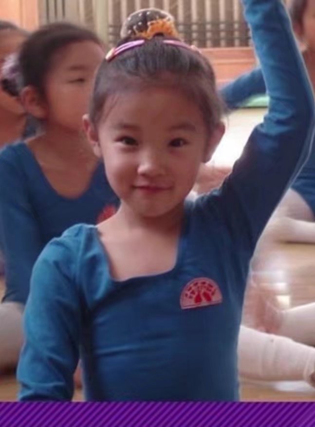 原创网友扒出宋雨琦童年照看清她真实容貌后说她整容的出来挨打