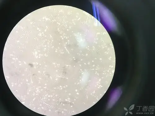 小鼠肝原代星状细胞培养