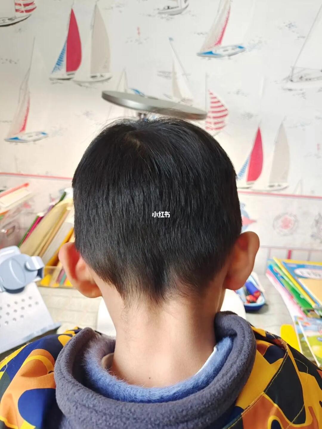 但是头顶看还是偏的,6周岁了,长大真的可以长好吗#偏头  #宝宝头型