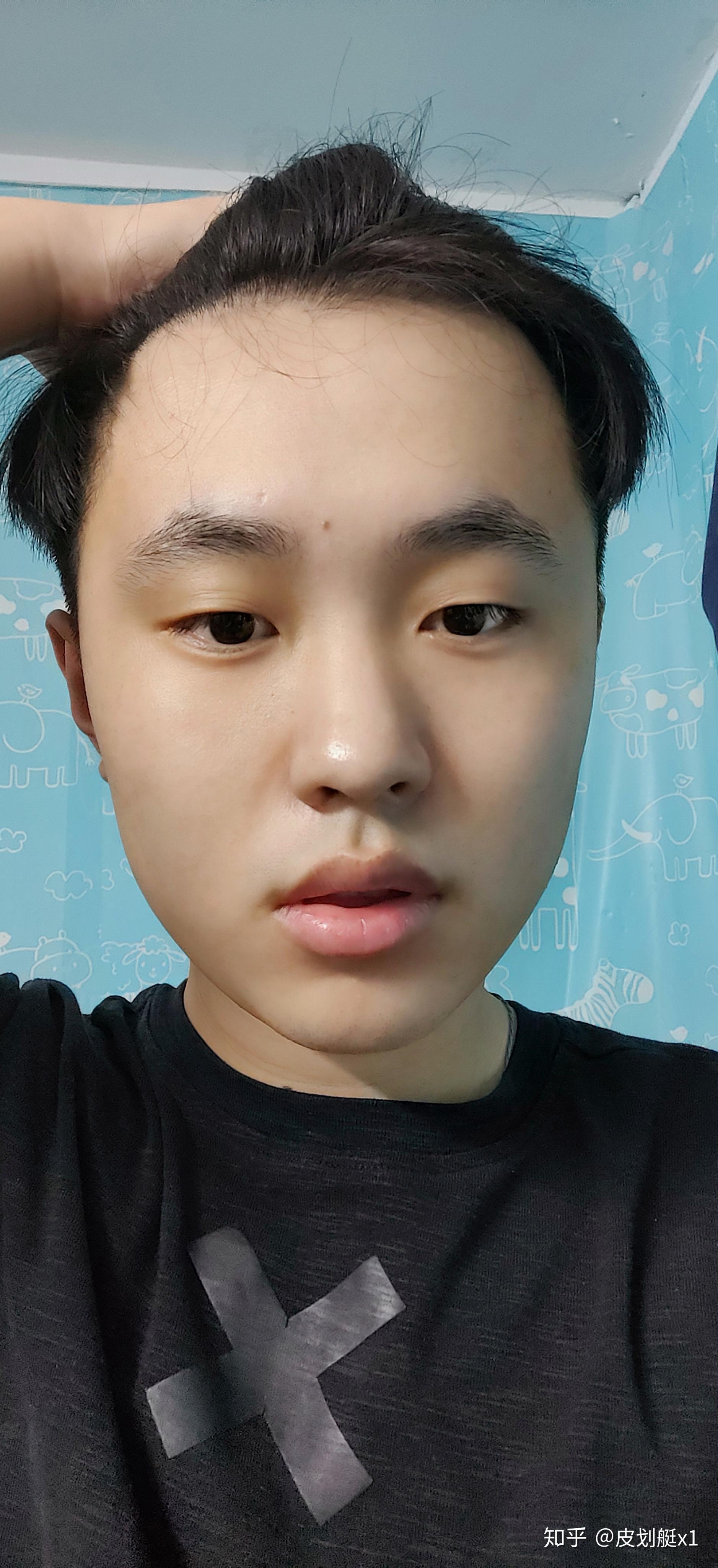 一加7pro原生无美颜照片首先是面部护肤(一天两次,一次大约2分钟,一个