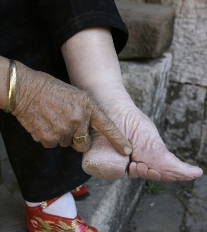 在中国古代,裹小脚似乎是汉族女性的一种普遍现象,不然就嫁不出去人