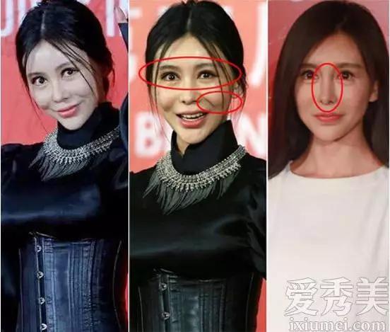 盘点整容失败的女明星后遗症难抵挡