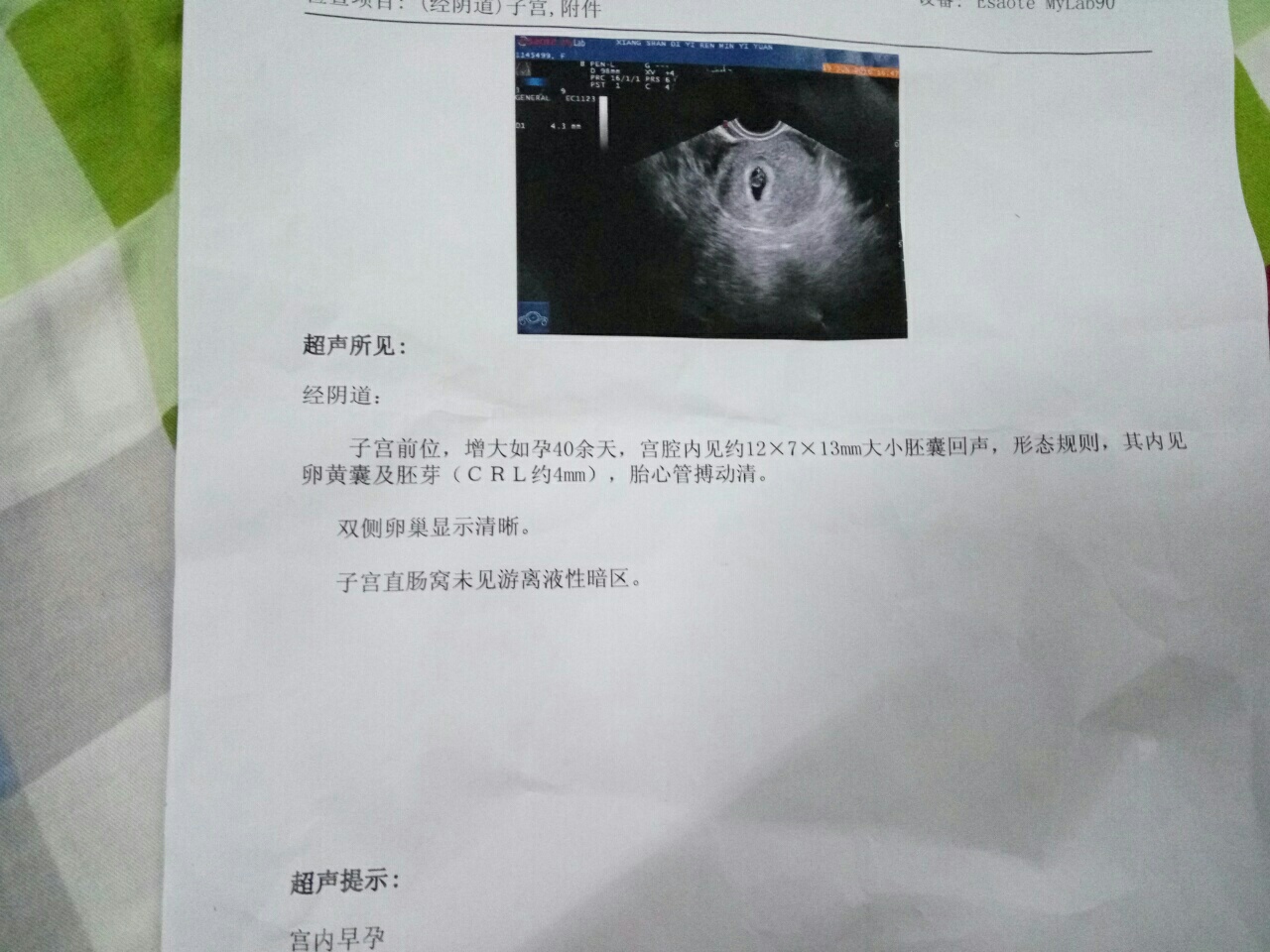 这个结果是不是说我怀孕已经有40天左右呢?