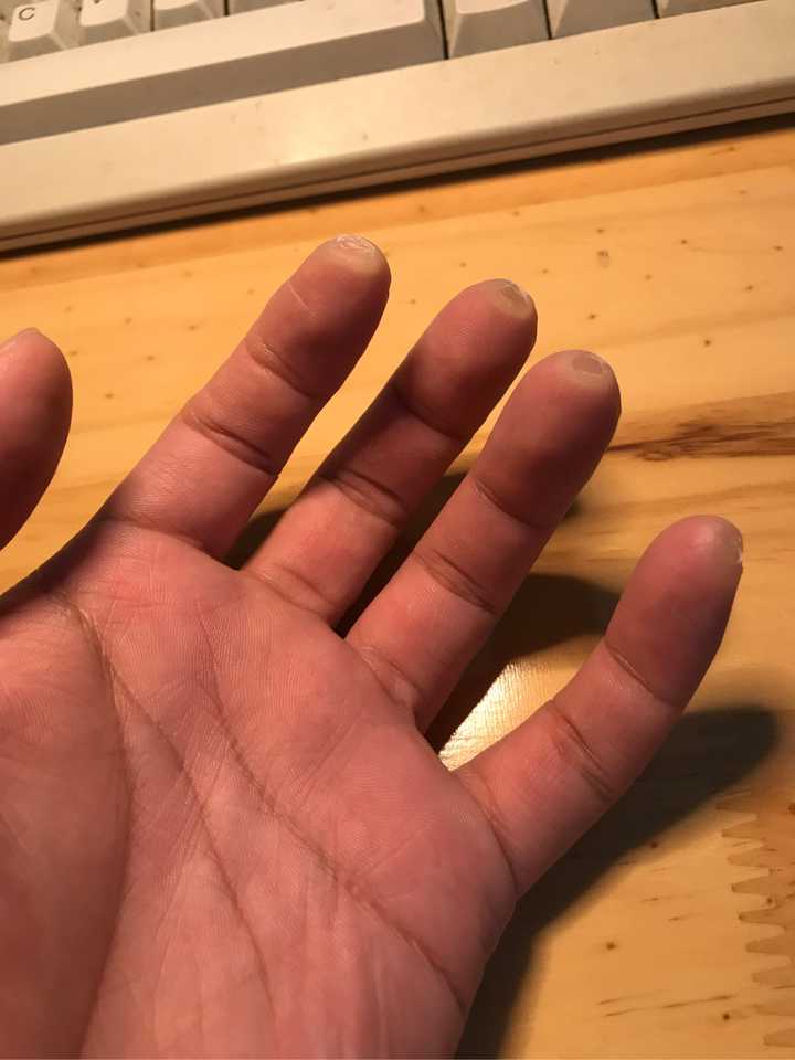 大家弹吉他的手指都是什么样的?