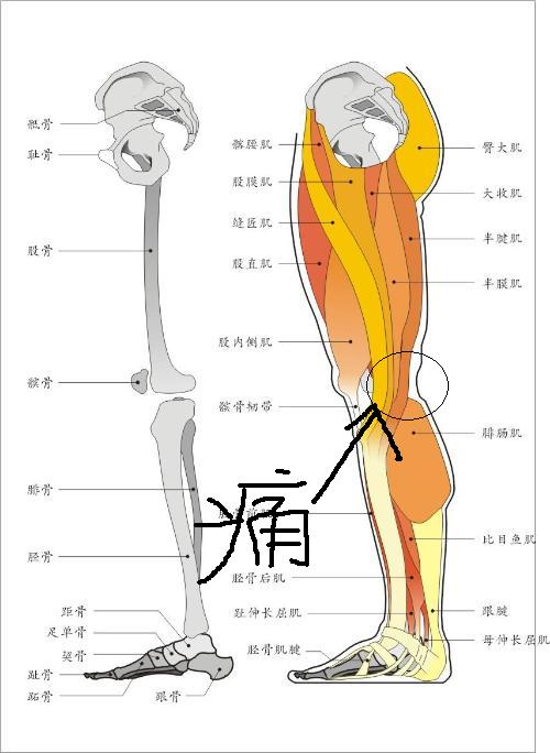 我的腿在一天内突然发痛,怎么回事 ?