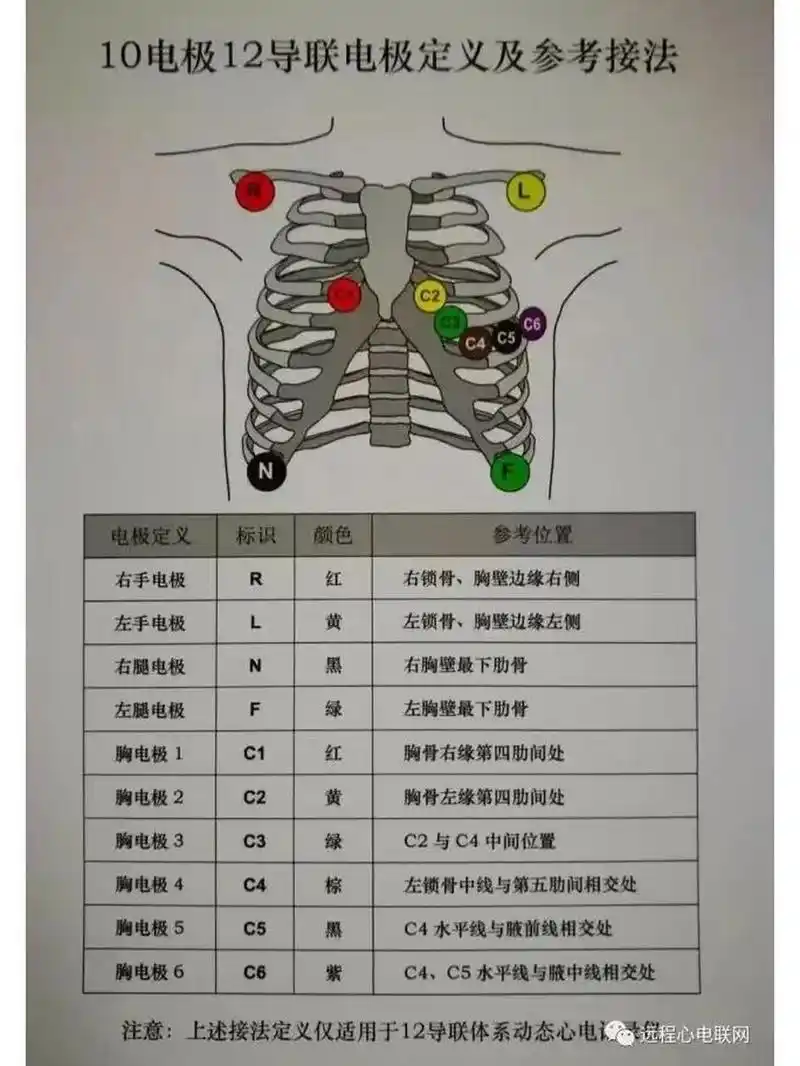 动态心电图位置
