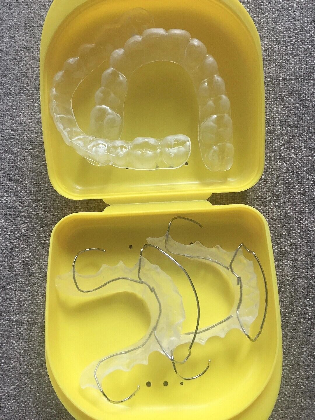 牙套整牙后透明保持器和哈雷保持器对比分享 95拆牙套8年,现在只是