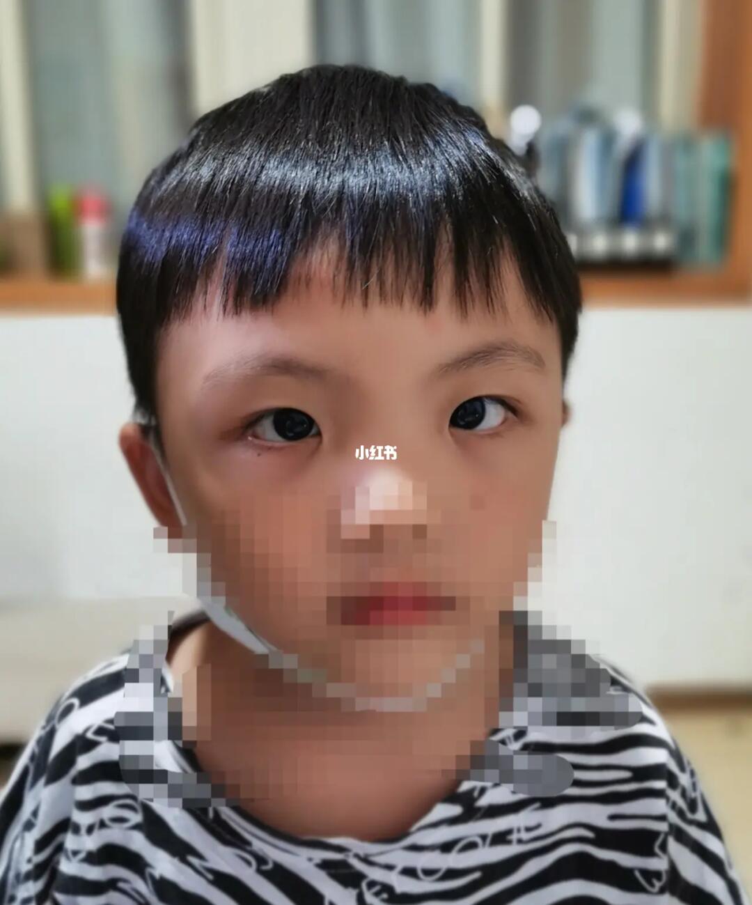 吼吼是假性内斜不知道大家猜对没有