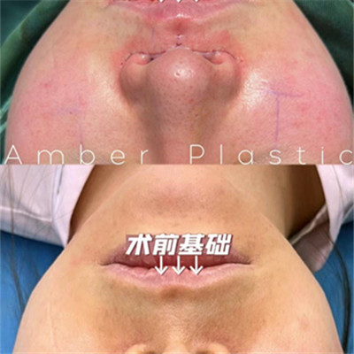 冰磁美牙培训黑龙江