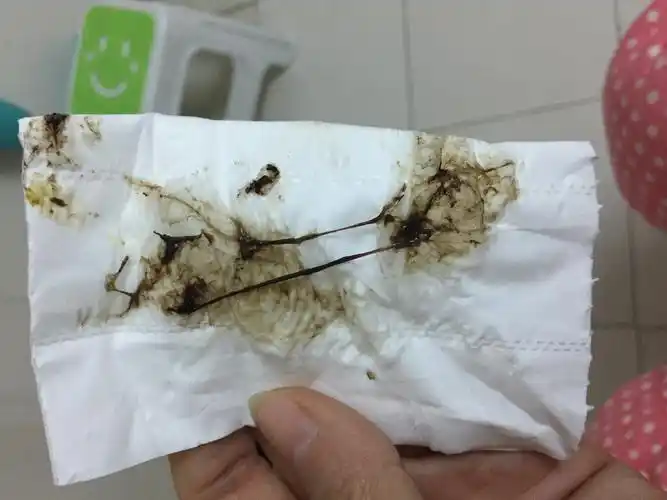 亲密!白带有血褐色分泌物怎么回事"孕妈必备"-第2张图片-追风博客