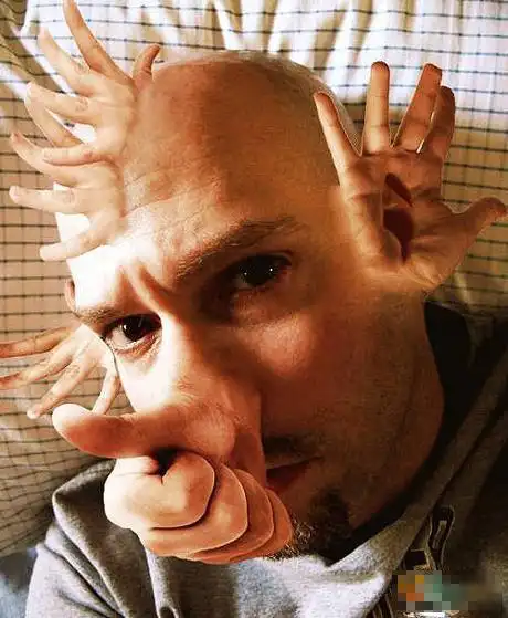 恶搞:你绝对没见过的畸形人(组图)