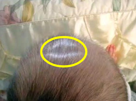 卤门是宝宝大脑发育的重要指标,过早过晚都不好,宝妈要引起重视