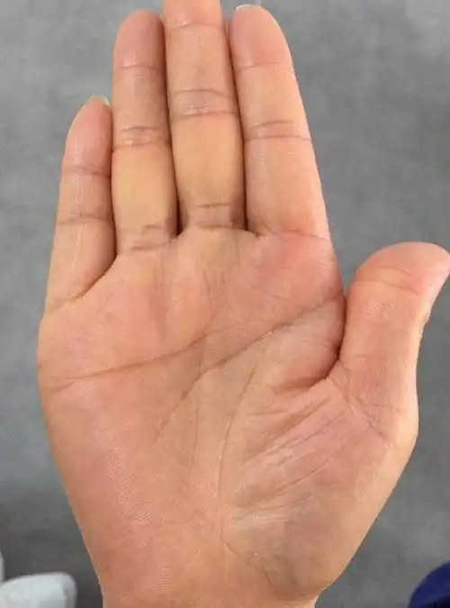 容易二婚的手相