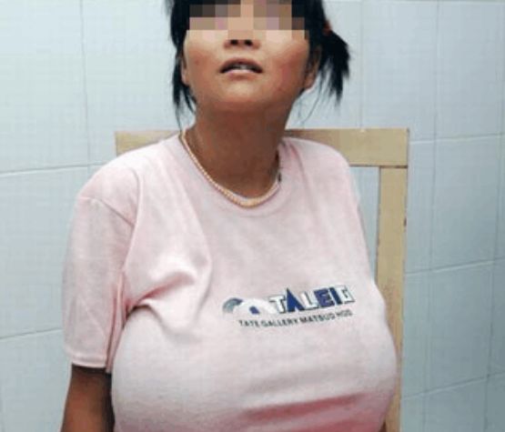 13岁女孩胸部大的异常受尽同学嘲笑手术过后让她重获新生