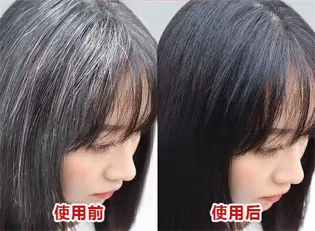 原创七年白发变黑发亲身经历看完少走弯路